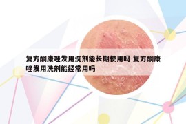 復(fù)方酮康唑發(fā)用洗劑能長期使用嗎 復(fù)方酮康唑發(fā)用洗劑能經(jīng)常用嗎