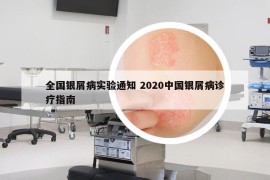 全國銀屑病實驗通知 2020中國銀屑病診療指南