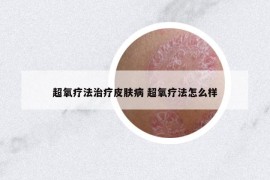 超氧療法治療皮膚病 超氧療法怎么樣