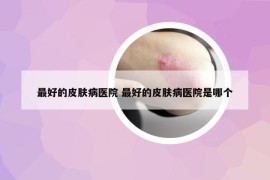 最好的皮膚病醫(yī)院 最好的皮膚病醫(yī)院是哪個
