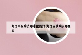 ?？谂Ｆぐ_去哪家醫(yī)院好 ?？谄つw病去哪里治