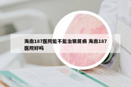海南187醫(yī)院能不能治銀屑病 海南187醫(yī)院好嗎