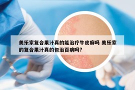 美樂家復(fù)合果汁真的能治療牛皮癬嗎 美樂家的復(fù)合果汁真的包治百病嗎?