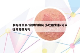 多吃維生素c會得白癜風(fēng) 多吃維生素c可以提高免疫力嗎
