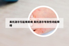 美托洛爾引起銀屑病 美托洛爾導(dǎo)致性功能障礙