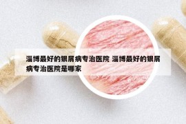淄博最好的銀屑病專治醫(yī)院 淄博最好的銀屑病專治醫(yī)院是哪家