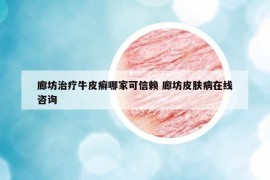 廊坊治療牛皮癬哪家可信賴 廊坊皮膚病在線咨詢