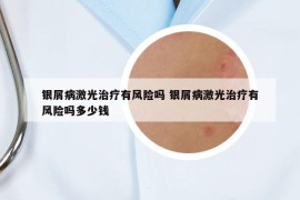 銀屑病激光治療有風(fēng)險嗎 銀屑病激光治療有風(fēng)險嗎多少錢