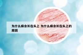 為什么癬會(huì)長(zhǎng)在頭上 為什么癬會(huì)長(zhǎng)在頭上的原因