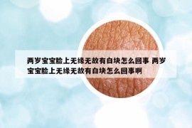 兩歲寶寶臉上無(wú)緣無(wú)故有白塊怎么回事 兩歲寶寶臉上無(wú)緣無(wú)故有白塊怎么回事啊