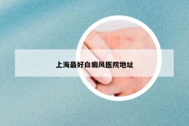 上海最好白癜風(fēng)醫(yī)院地址