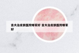 吉大治皮膚醫(yī)院哪家好 吉大治皮膚醫(yī)院哪家好