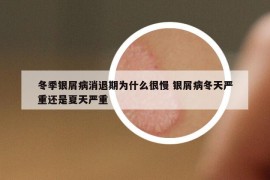 冬季銀屑病消退期為什么很慢 銀屑病冬天嚴(yán)重還是夏天嚴(yán)重