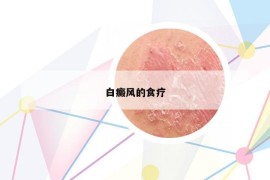 白癜風(fēng)的食療