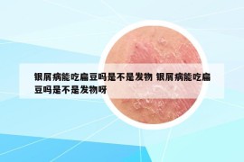 銀屑病能吃扁豆嗎是不是發(fā)物 銀屑病能吃扁豆嗎是不是發(fā)物呀