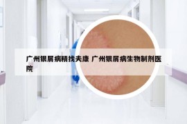 廣州銀屑病精找夫康 廣州銀屑病生物制劑醫(yī)院