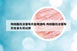 枸櫞酸托法替布片能喝酒嗎 枸櫞酸托法替布片吃多久可以停