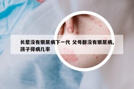 長輩沒有銀屑病下一代 父母都沒有銀屑病,孩子得病幾率