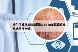 哈爾濱盛京皮膚病醫(yī)院360 哈爾濱盛京皮膚病醫(yī)院電話