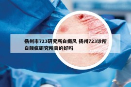 揚州市723研究所白癜風 揚州723診所白顛瘋研究所真的好嗎