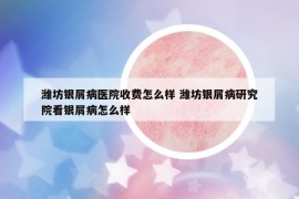 濰坊銀屑病醫(yī)院收費(fèi)怎么樣 濰坊銀屑病研究院看銀屑病怎么樣