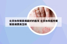 北京協(xié)和銀屑病最好的醫(yī)生 北京協(xié)和醫(yī)院看銀屑病費(fèi)用怎樣