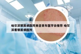 哈爾濱銀屑病醫(yī)院來咨青年醫(yī)學(xué)會推薦 哈爾濱看銀屑病醫(yī)院