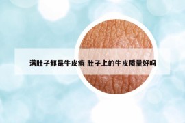 滿肚子都是牛皮癬 肚子上的牛皮質(zhì)量好嗎