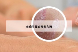 有癬不要吃那些東西