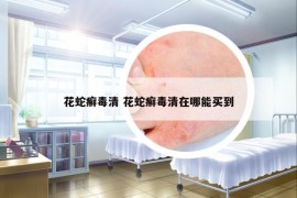 花蛇癬毒清 花蛇癬毒清在哪能買到