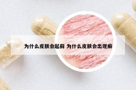 為什么皮膚會起蘚 為什么皮膚會出現(xiàn)癬