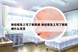 體檢報(bào)告上寫了銀屑病 體檢報(bào)告上寫了銀屑病什么意思
