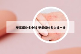 甲氨蝶呤多少錢(qián) 甲氨蝶呤多少錢(qián)一針