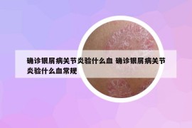 確診銀屑病關(guān)節(jié)炎驗(yàn)什么血 確診銀屑病關(guān)節(jié)炎驗(yàn)什么血常規(guī)