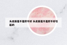 頭皮蘚是不是肝不好 頭皮蘚是不是肝不好引起的