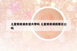 兒童銀屑病食譜大棗嗎 兒童銀屑病需要忌口嗎