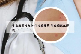 牛皮廨圖片大全 牛皮廨圖片 牛皮廨怎么得的