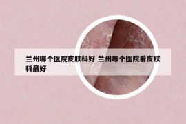 蘭州哪個(gè)醫(yī)院皮膚科好 蘭州哪個(gè)醫(yī)院看皮膚科最好