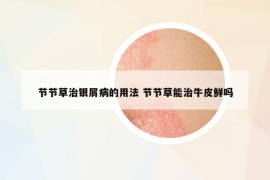 節(jié)節(jié)草治銀屑病的用法 節(jié)節(jié)草能治牛皮鮮嗎