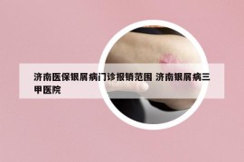 濟(jì)南醫(yī)保銀屑病門診報(bào)銷范圍 濟(jì)南銀屑病三甲醫(yī)院