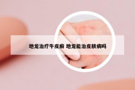 地龍治療牛皮癬 地龍能治皮膚病嗎