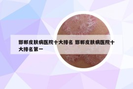 邯鄲皮膚病醫(yī)院十大排名 邯鄲皮膚病醫(yī)院十大排名第一