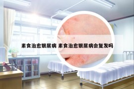 素食治愈銀屑病 素食治愈銀屑病會復(fù)發(fā)嗎