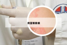 陰莖銀屑病