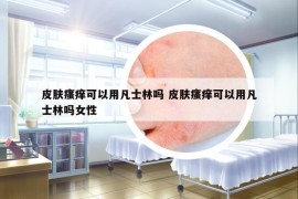 皮膚瘙癢可以用凡士林嗎 皮膚瘙癢可以用凡士林嗎女性