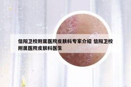 信陽衛(wèi)校附屬醫(yī)院皮膚科專家介紹 信陽衛(wèi)校附屬醫(yī)院皮膚科醫(yī)生