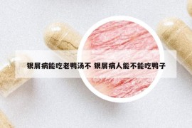 銀屑病能吃老鴨湯不 銀屑病人能不能吃鴨子