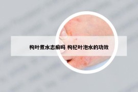枸葉煮水志癬嗎 枸杞葉泡水的功效