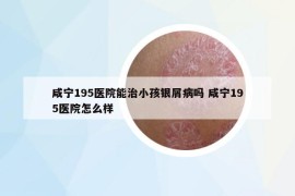 咸寧195醫(yī)院能治小孩銀屑病嗎 咸寧195醫(yī)院怎么樣