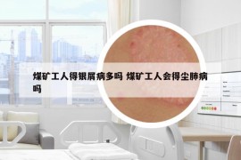 煤礦工人得銀屑病多嗎 煤礦工人會(huì)得塵肺病嗎